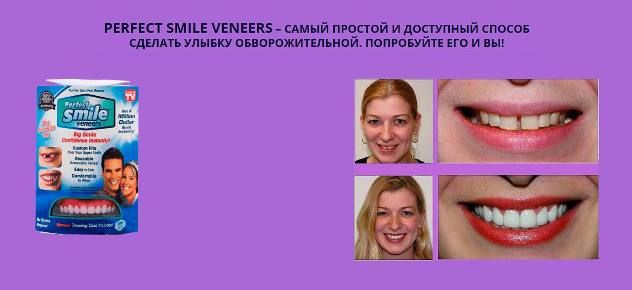 Perfect Smile Виниры Где Купить В Омске